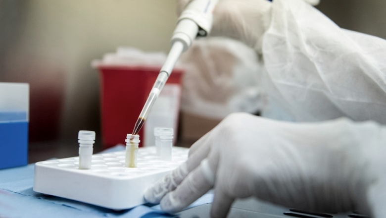 ¿Por qué se probará una vacuna contra el coronavirus en Argentina?