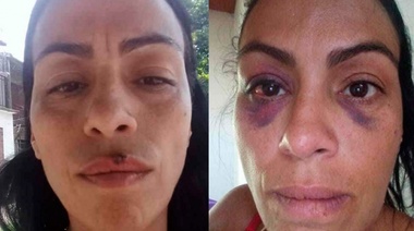 Luego de denunciarlo 29 veces por violencia de género detuvieron a la ex pareja de Betiana Correa