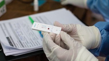 ANMAT autorizó la venta libre en farmacias del test rápido de coronavirus