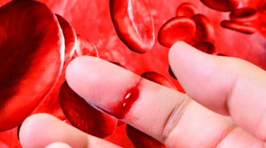 ¿Qué es la hemofilia?
