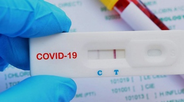 El autotest de Covid-19 se venderá en las farmacias