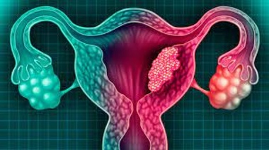 26 de marzo, Día Internacional de la Prevención contra el Cáncer de Cuello Uterino.