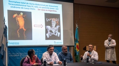En el Hospital El Cruce realizaron el primer reemplazo de aorta abdominal de urgencia en la Argentina