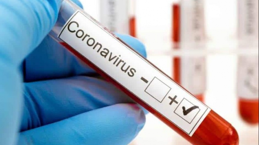 Coronavirus: ¿Cuántos infectados hay en la región? - Varela Informa